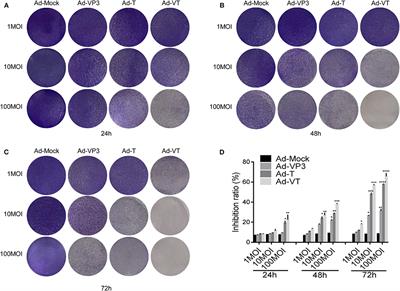 Chemovirotherapy of Lung Squamous Cell Carcinoma by Combining Oncolytic Adenovirus With Gemcitabine